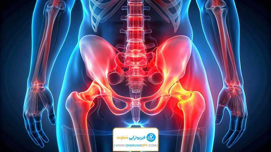 آماده‌سازی برای جراحی تعویض مفصل