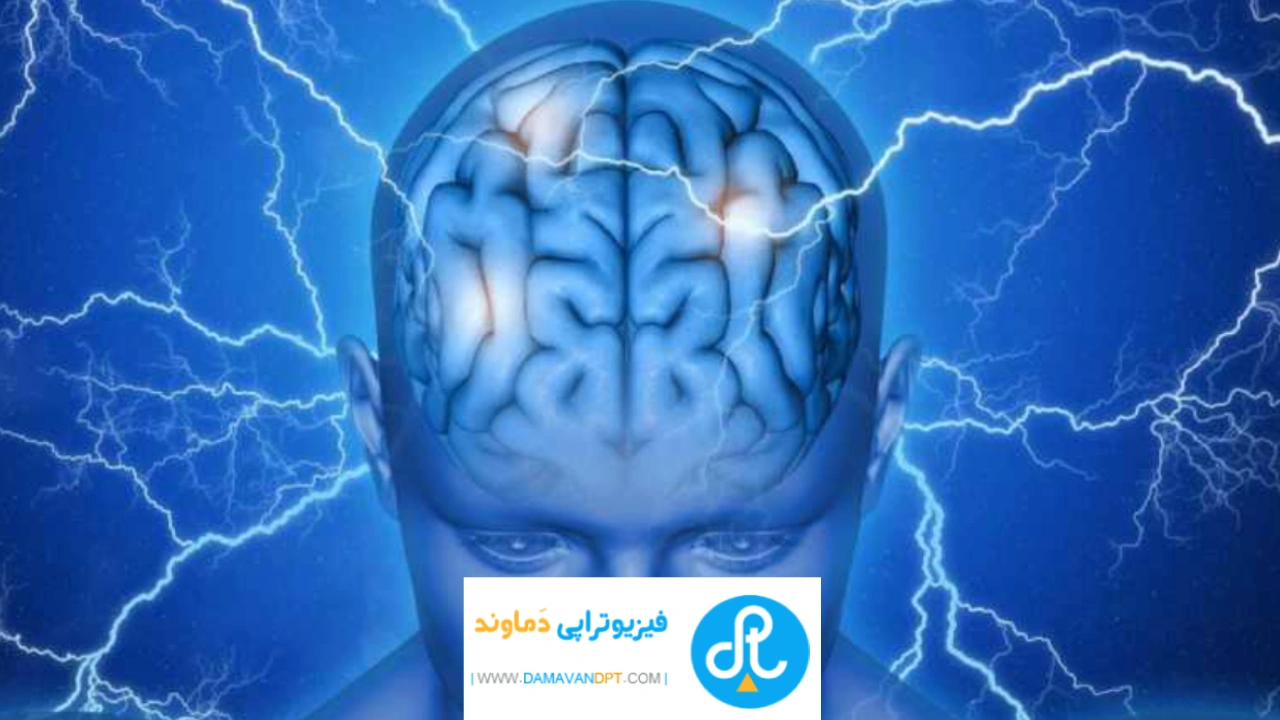 درمان فیزیوتراپی در درمان دردسر