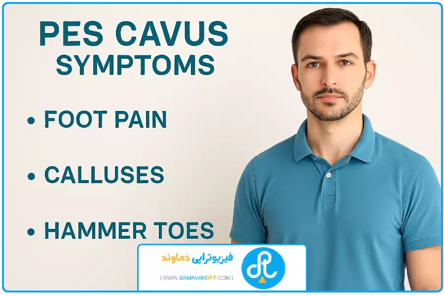 علایم و تشخیص | درمان کف پای گود با فیزیوتراپی
