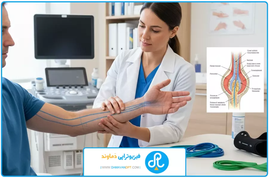 بند نخستین | فیزیوتراپی تونل کارپال