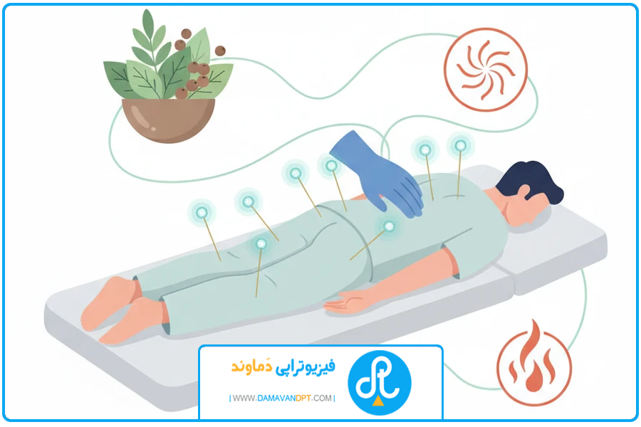 ترکیب با مابقی روش ها | درمان دیسک کمر با طب سوزنی