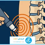 تصویر شاخص | شاک ویو دیسک کمر