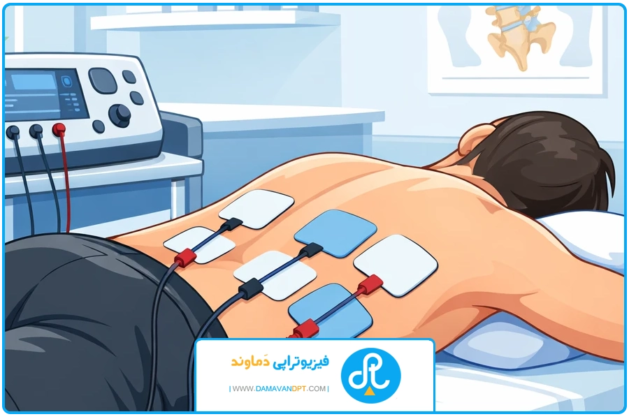 تصویر شاخص | الکتروتراپی دیسک کمر