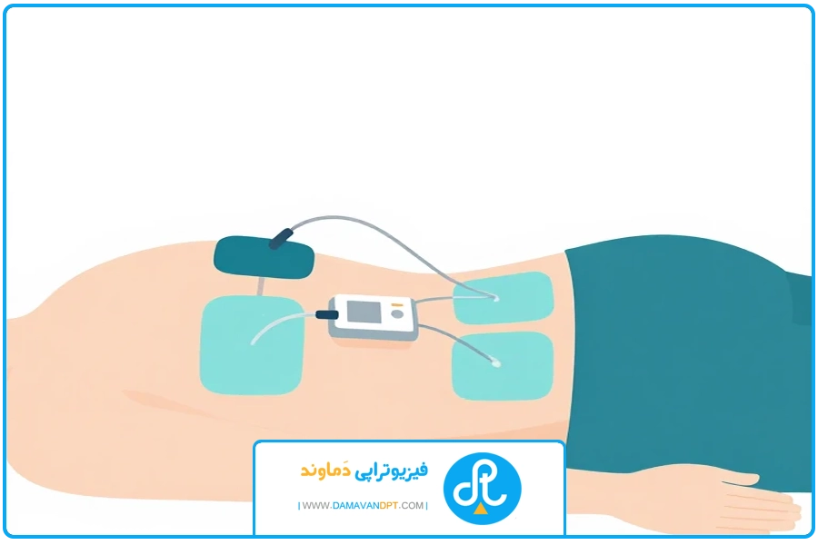 بند پایانی | الکتروتراپی دیسک کمر