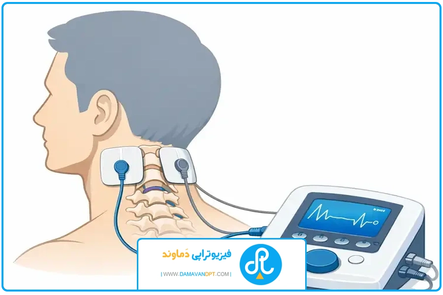 تحلیل هزینه | الکتروتراپی دیسک گردن