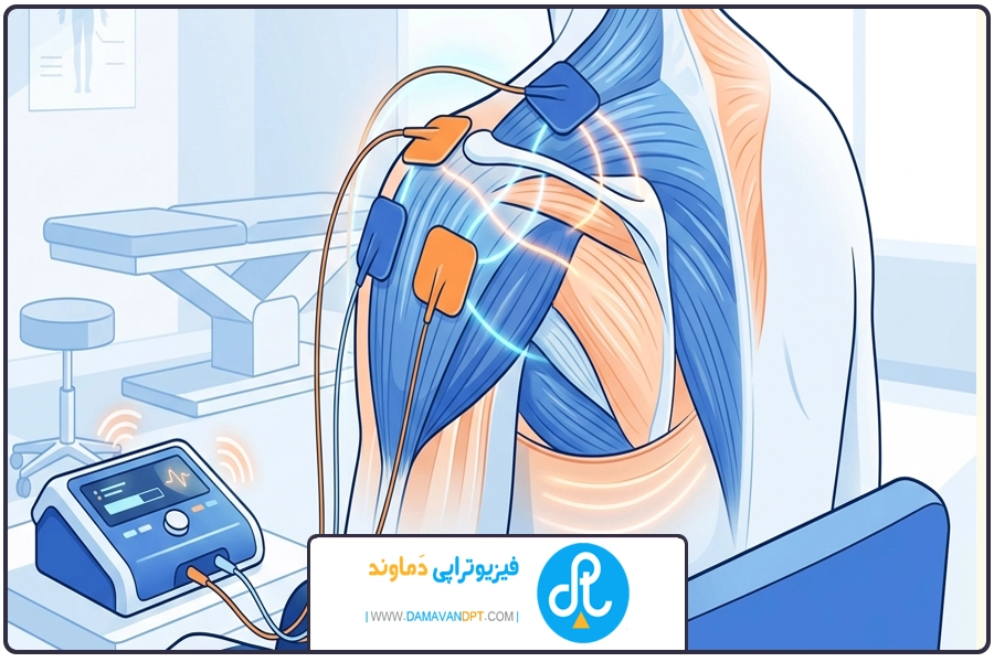 احساس بیماری در طول فرآیند | الکتروتراپی درد کتف