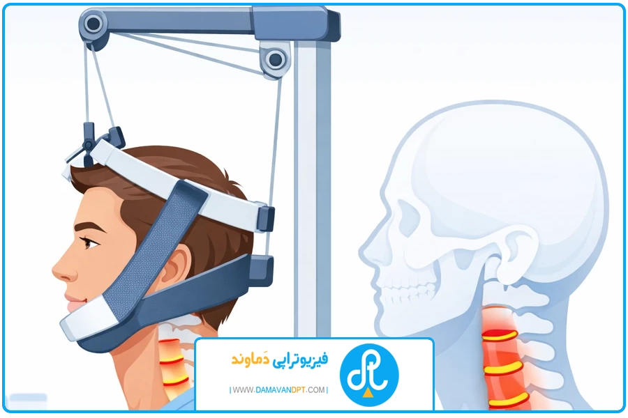 اصلاح سبک زندگی | مکانوتراپی دیسک گردن