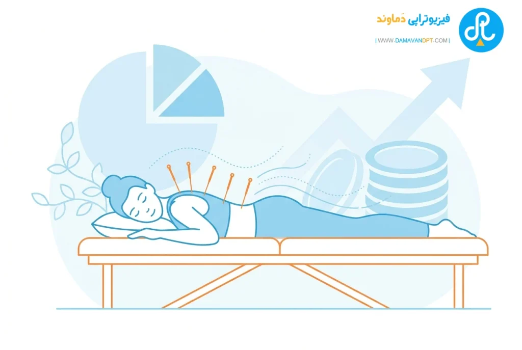 هزینه طب سوزنی | هزینه فیزیوتراپی در شیراز