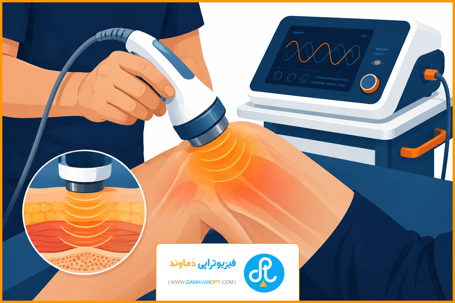 بخش های پایانی | کاربرد اولتراسوند در فیزیوتراپی
