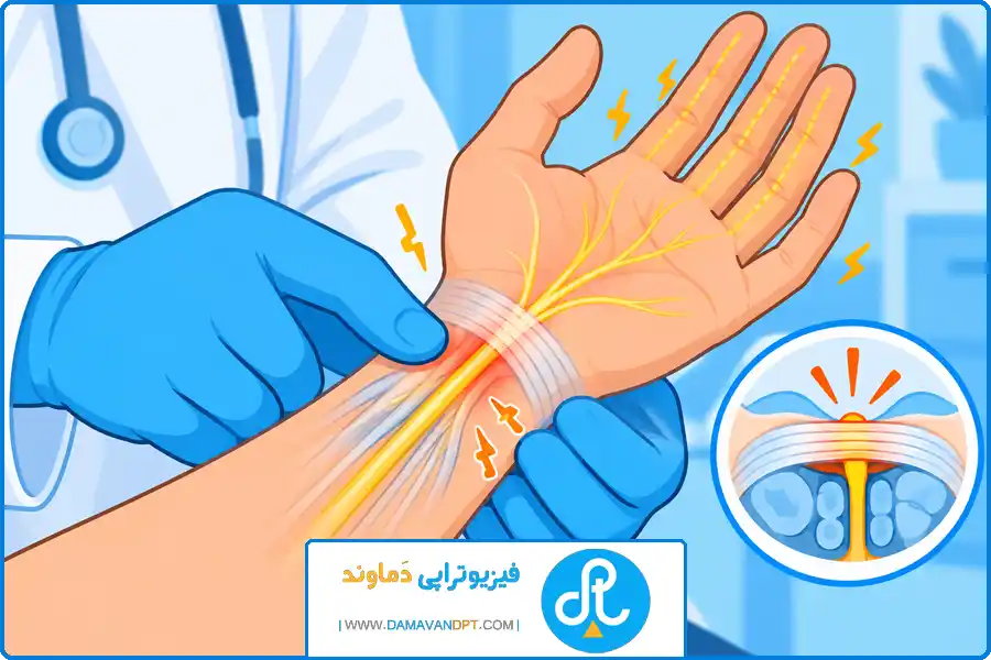 تی وی وال شهرکرد | دردهای تیرکشنده و عصبی