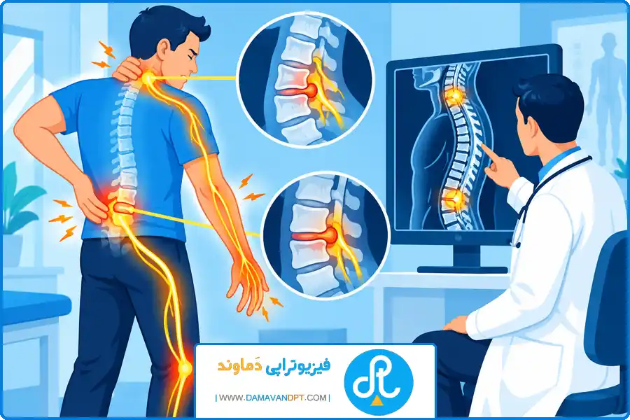تی وی وال شهرکرد | سندرم تونل کارپال